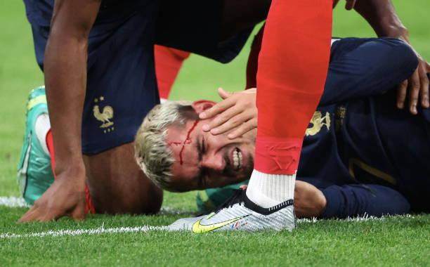 开云官网-姆皇破法国纪录，54球平哈兰德！“小公主”挂哨抢戏